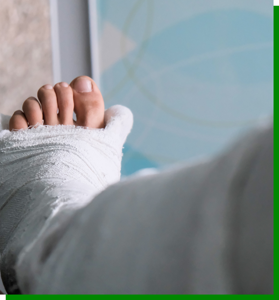 leg in a cast